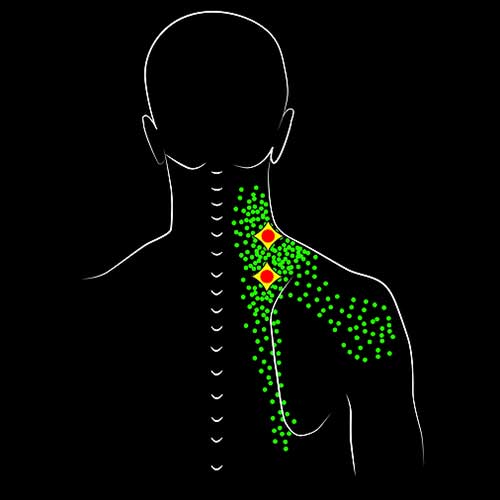 manitou-wellness-center-colorado-springs-Myofascial-Release